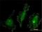 Protein Kinase N2 antibody, H00005586-M01, Novus Biologicals, Immunocytochemistry image 