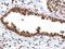 Apurinic/Apyrimidinic Endodeoxyribonuclease 1 antibody, PA5-29157, Invitrogen Antibodies, Immunohistochemistry paraffin image 