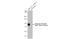 Androgen Receptor antibody, GTX636639, GeneTex, Western Blot image 