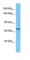 Semaphorin 3B antibody, orb327191, Biorbyt, Western Blot image 