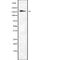 Death Associated Protein Kinase 1 antibody, abx149731, Abbexa, Western Blot image 