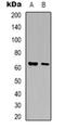 ORAI Calcium Release-Activated Calcium Modulator 1 antibody, orb74861, Biorbyt, Western Blot image 