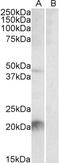 Afamin antibody, 43-131, ProSci, Western Blot image 