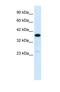 Complement Component 4 Binding Protein Beta antibody, NBP1-58983, Novus Biologicals, Western Blot image 