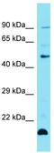 Zinc finger protein 27 antibody, TA341495, Origene, Western Blot image 