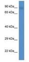 Protein Phosphatase 4 Regulatory Subunit 3B antibody, NBP1-79673, Novus Biologicals, Western Blot image 