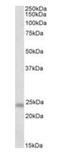 GM2 Ganglioside Activator antibody, orb22519, Biorbyt, Western Blot image 