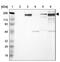 Laminin Subunit Beta 2 antibody, NBP1-87717, Novus Biologicals, Western Blot image 