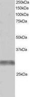 Tripartite Motif Containing 7 antibody, PA1-31903, Invitrogen Antibodies, Western Blot image 