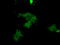 Protein Kinase CGMP-Dependent 1 antibody, M01708, Boster Biological Technology, Immunofluorescence image 