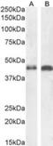 Arrestin Beta 2 antibody, NB100-1515, Novus Biologicals, Western Blot image 