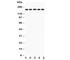 Collagen Type IV Alpha 1 Chain antibody, R30613, NSJ Bioreagents, Western Blot image 