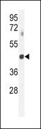 G Protein Subunit Alpha Transducin 2 antibody, PA5-24553, Invitrogen Antibodies, Western Blot image 