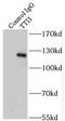 TELO2 Interacting Protein 1 antibody, FNab09093, FineTest, Immunoprecipitation image 