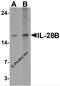 Interferon Lambda 3 antibody, 7479, ProSci, Western Blot image 