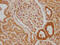 Sorting Nexin 5 antibody, CSB-PA872015LA01HU, Cusabio, Immunohistochemistry frozen image 