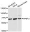 Protein Phosphatase, Mg2+/Mn2+ Dependent 1J antibody, A12844, ABclonal Technology, Western Blot image 