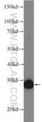 Electron Transfer Flavoprotein Subunit Beta antibody, 17925-1-AP, Proteintech Group, Western Blot image 