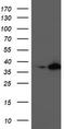 Nudix Hydrolase 18 antibody, TA503828, Origene, Western Blot image 