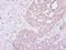 Phenylalanyl-TRNA Synthetase Subunit Alpha antibody, GTX104924, GeneTex, Immunohistochemistry paraffin image 