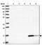 Retinol Binding Protein 5 antibody, NBP2-32643, Novus Biologicals, Western Blot image 