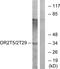 Olfactory Receptor Family 2 Subfamily T Member 5 antibody, GTX87569, GeneTex, Western Blot image 