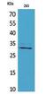 Cell Growth Regulator With EF-Hand Domain 1 antibody, STJ96741, St John