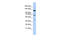 Regulatory Factor X1 antibody, 25-416, ProSci, Enzyme Linked Immunosorbent Assay image 