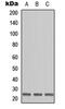 Ornithine Decarboxylase Antizyme 1 antibody, abx121538, Abbexa, Western Blot image 