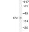 Prostaglandin E Receptor 2 antibody, LS-C177301, Lifespan Biosciences, Western Blot image 