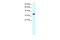 Forkhead Box F1 antibody, 27-541, ProSci, Western Blot image 