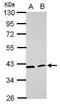 Acyl-CoA Dehydrogenase Long Chain antibody, GTX100486, GeneTex, Western Blot image 
