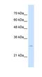 Tetraspanin 32 antibody, NBP1-62492, Novus Biologicals, Western Blot image 