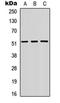 SMAD Family Member 3 antibody, orb304596, Biorbyt, Western Blot image 