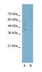 Potassium Voltage-Gated Channel Subfamily Q Member 5 antibody, orb329935, Biorbyt, Western Blot image 