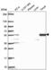 Tetratricopeptide Repeat Domain 39C antibody, NBP2-56001, Novus Biologicals, Western Blot image 