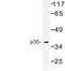 Cyclin Dependent Kinase 5 Regulatory Subunit 1 antibody, LS-C176814, Lifespan Biosciences, Western Blot image 