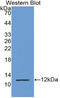 S100 Calcium Binding Protein P antibody, LS-C314270, Lifespan Biosciences, Western Blot image 