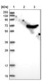 Carnitine O-Octanoyltransferase antibody, NBP1-85503, Novus Biologicals, Western Blot image 