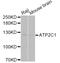 ATPase Secretory Pathway Ca2+ Transporting 1 antibody, STJ22721, St John