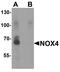 NADPH Oxidase 4 antibody, PA5-72816, Invitrogen Antibodies, Western Blot image 