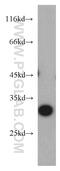 Solute Carrier Family 25 Member 2 antibody, 21764-1-AP, Proteintech Group, Western Blot image 