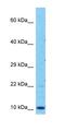 Zinc Finger AN1-Type Containing 2A antibody, orb326290, Biorbyt, Western Blot image 