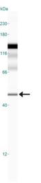 Glucagon Like Peptide 1 Receptor antibody, NLS1205, Novus Biologicals, Western Blot image 