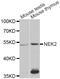 NIMA Related Kinase 2 antibody, STJ27308, St John