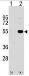 Sprouty Related EVH1 Domain Containing 1 antibody, AP11430PU-N, Origene, Western Blot image 