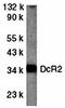 TNF Receptor Superfamily Member 10d antibody, orb74348, Biorbyt, Western Blot image 