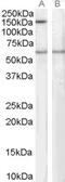 Signal-Induced Proliferation-Associated 1 antibody, 46-371, ProSci, Enzyme Linked Immunosorbent Assay image 