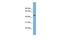 Actin Related Protein 3B antibody, GTX44913, GeneTex, Western Blot image 