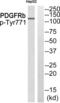 Platelet Derived Growth Factor Receptor Beta antibody, abx012622, Abbexa, Western Blot image 
